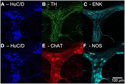 Sympathetic Pathways Target Cholinergic Neurons in the Human Colonic Myenteric Plexus